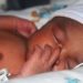 Lower rates of adolescent Cesarean delivery, but increased neonatal morbidity