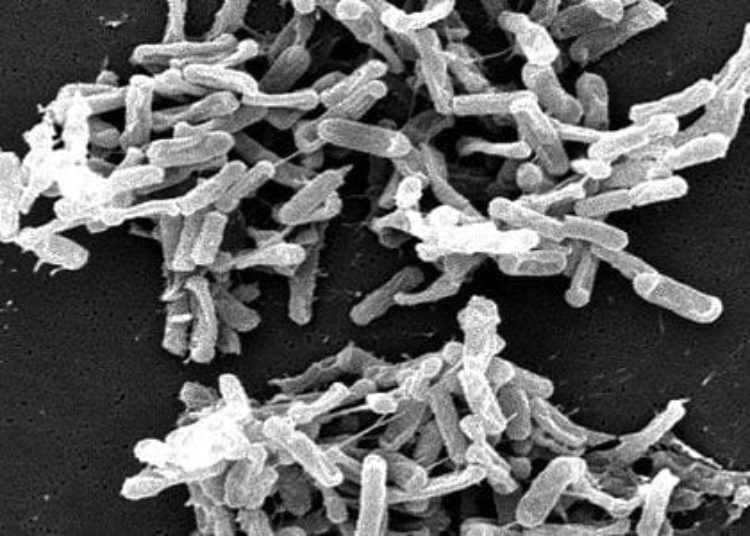 Non-toxigenic spores may prevent recurrent Clostridium difficile infection