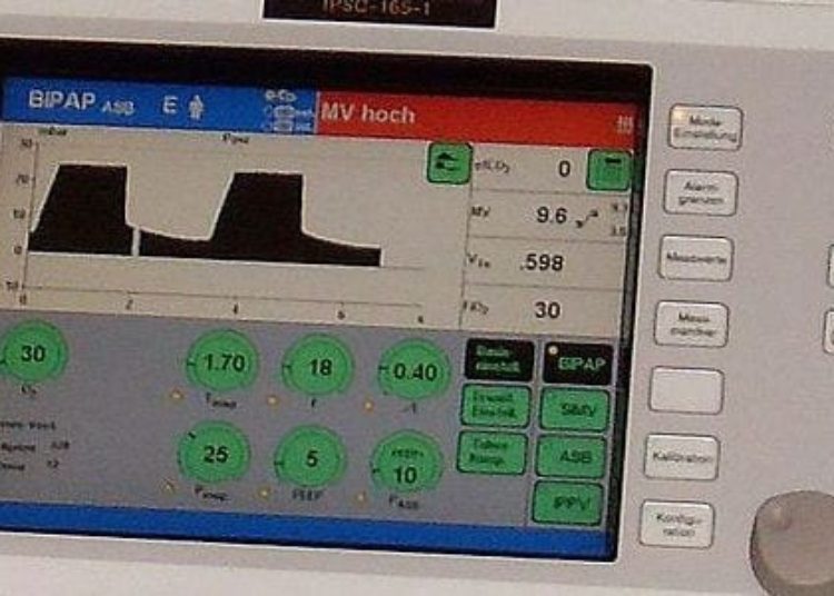 High-flow oxygen therapy as effective as BiPAP in preventing reintubation