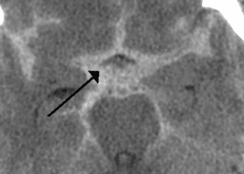 2 Minute Medicine Rewind June 1 – June 7, 2015