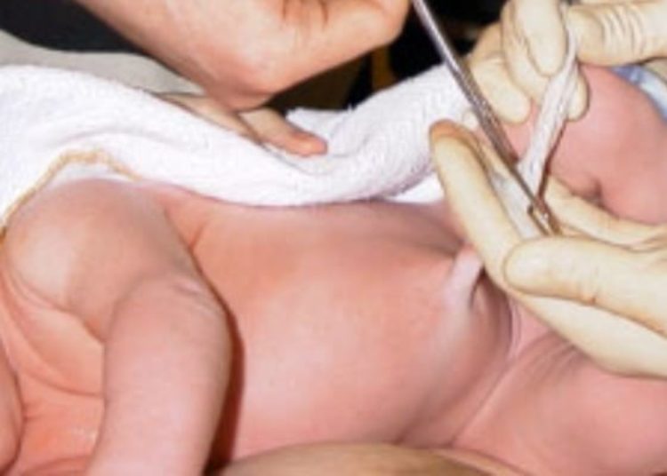 Umbilical cord milking improves placental transfusion