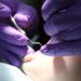 Preventative oral health by pediatricians can reduce dental caries
