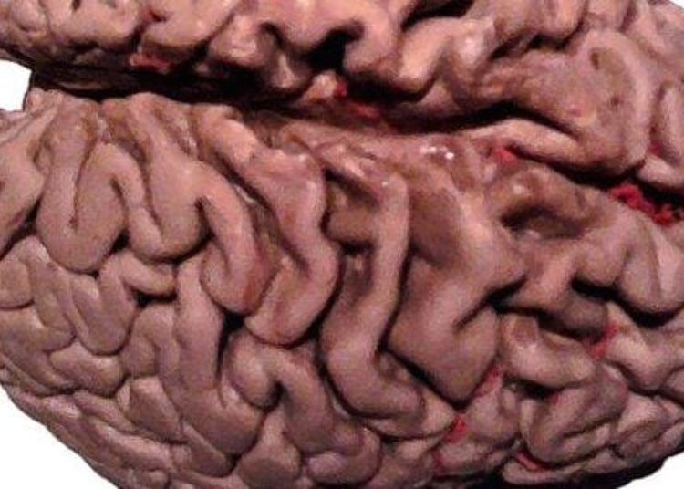 Free alternatives comparable to Mini-Mental State Examination