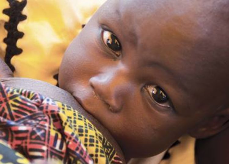 Exclusive breastfeeding linked to decrease in dental malocclusions