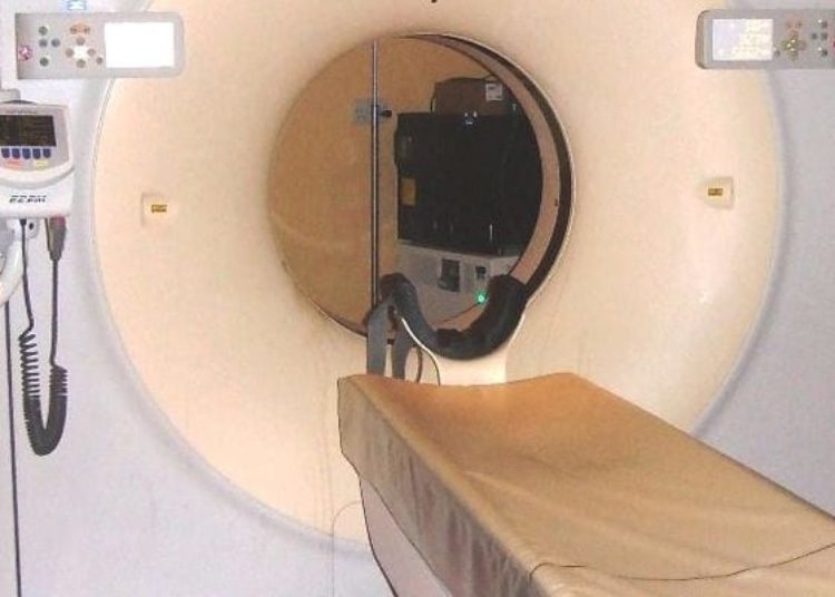 Annual CT safe and effective for screening of nonsolid lung nodules