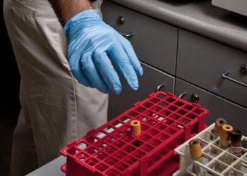 Significant reduction in prostate screening rates after revised guidelines