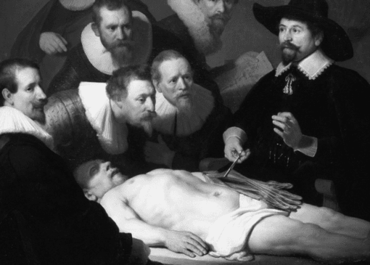 Adverse pregnancy outcomes associated with thrombophilias [Classics Series]