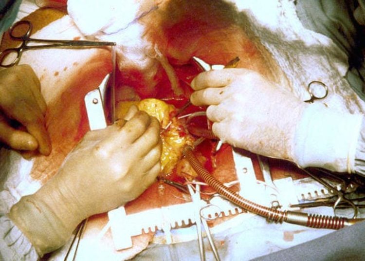 Cognitive outcomes in older adults undergoing cardiovascular procedures unclear