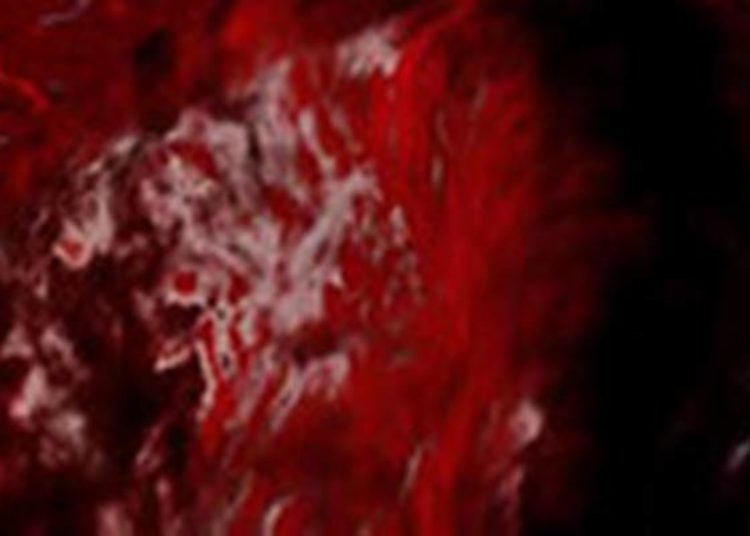 Significant bleeding following percutaneous biopsy is rare