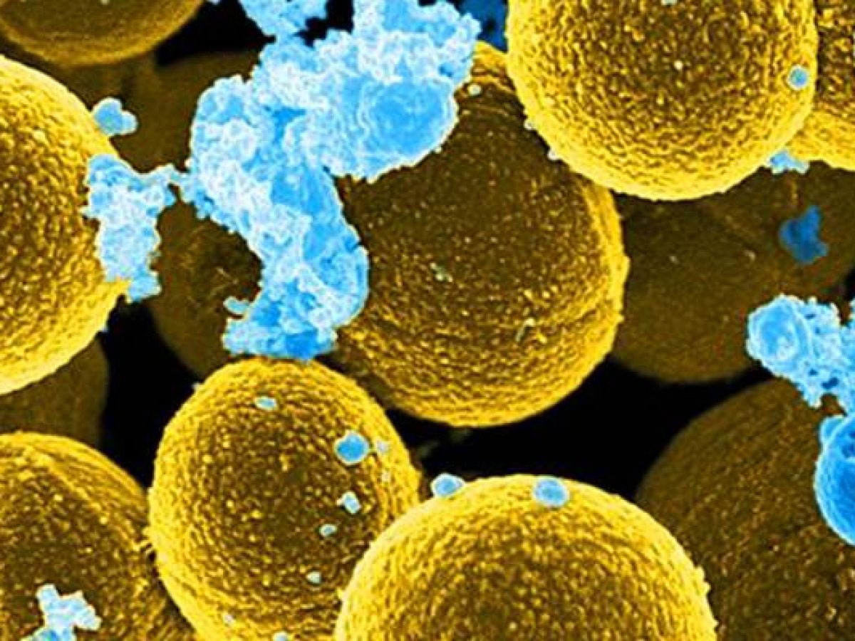 The OVIVA trial: oral antibiotics noninferior to intravenous antibiotics for bone and joint infections | 2 Minute Medicine The OVIVA trial: oral antibiotics noninferior to intravenous antibiotics for bone and joint infections | 2 Minute Medicine