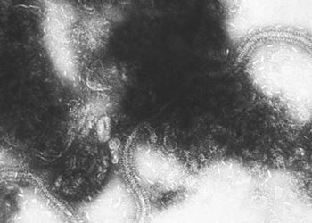 Respiratory virus positivity should not exclude Kawasaki disease