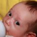 Head circumference better predicts labor dystocia than weight