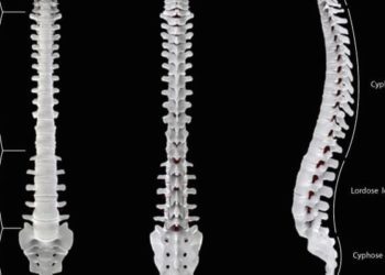 Epidural corticosteroid injections provide only short-term radiculopathy pain relief