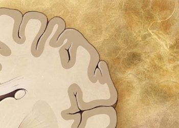 Cardiovascular risk factors related to brain volume and associated dementia