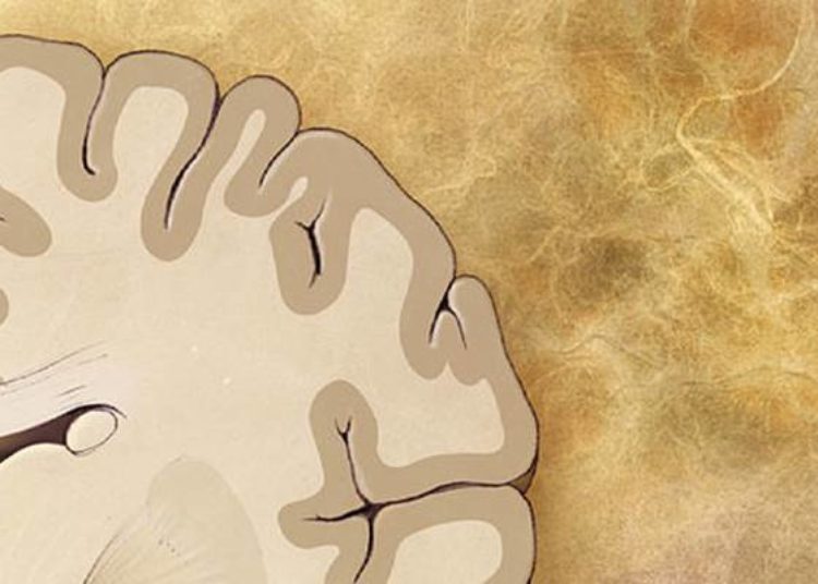 Cardiovascular risk factors related to brain volume and associated dementia