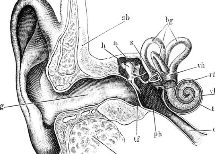 Hearing screening may not detect all infants with hearing loss