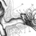 Hearing screening may not detect all infants with hearing loss