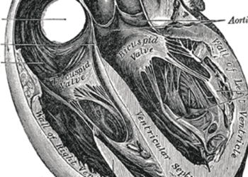 Image-guided percutaneous drainage of pericardial effusions is safe and effective