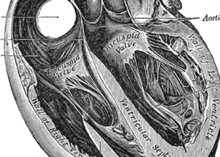 Image-guided percutaneous drainage of pericardial effusions is safe and effective