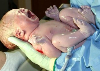 Apgar score not predictive of mortality or neurological outcome