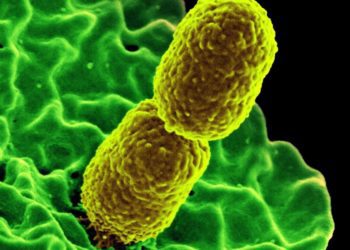 Nanoparticles targeting immune cell surface proteins may protect from sepsis [PreClinical]