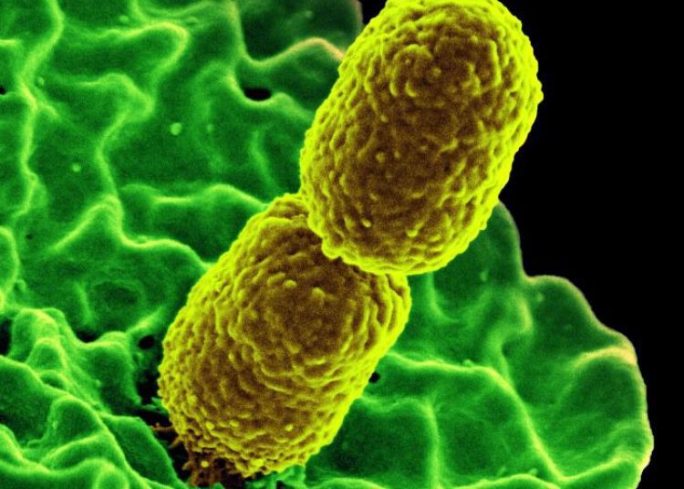Nanoparticles targeting immune cell surface proteins may protect from sepsis [PreClinical]