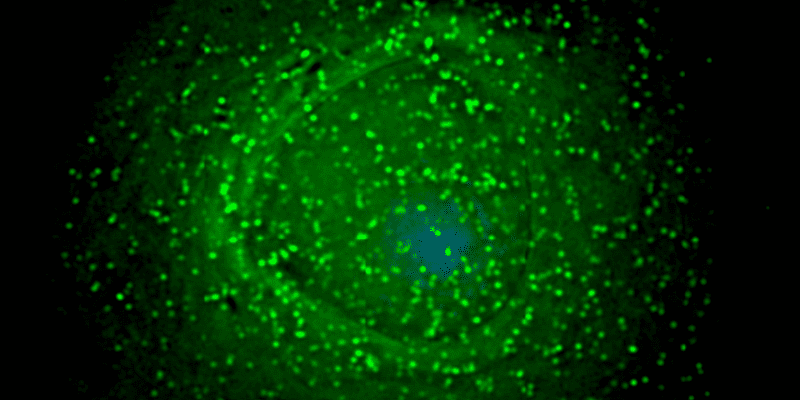 HIV_on_macrophage