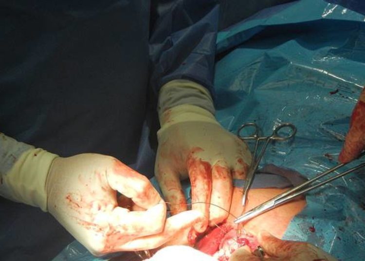 No differences in pain between suture and staple C-Section closure
