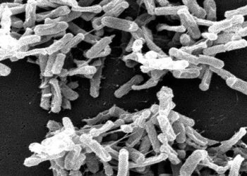Molecular testing for Clostridium difficile may not predict disease activity