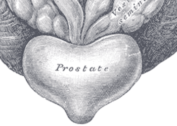 Active surveillance in favorable-risk prostate cancer associated with low long-term mortality