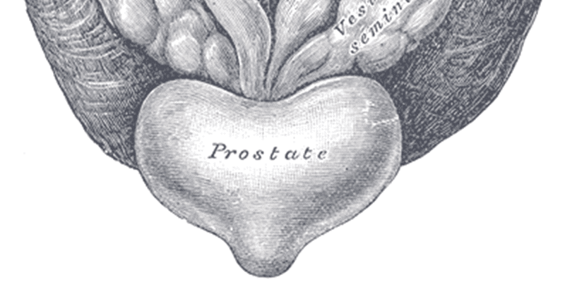 PD prostate