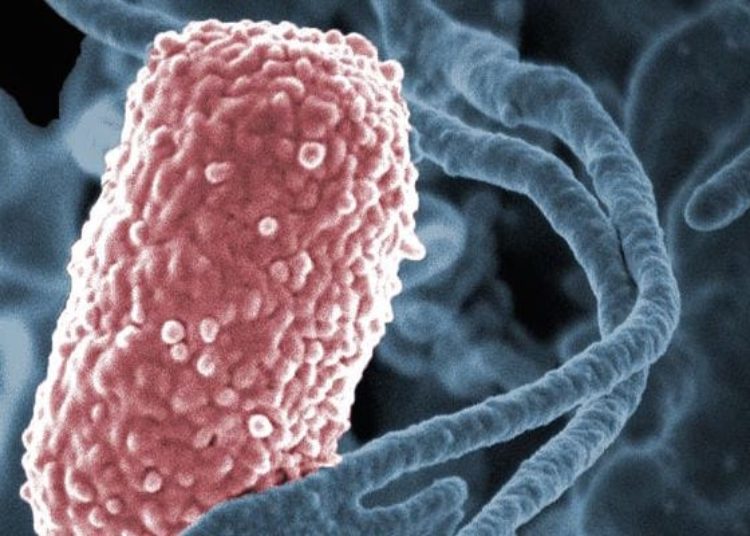 Carbapenem-resistant bacterial infections associated with prior hospitalizations and comorbid conditions