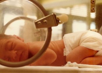 Stochastic resonance stimulation may decrease apnea of prematurity