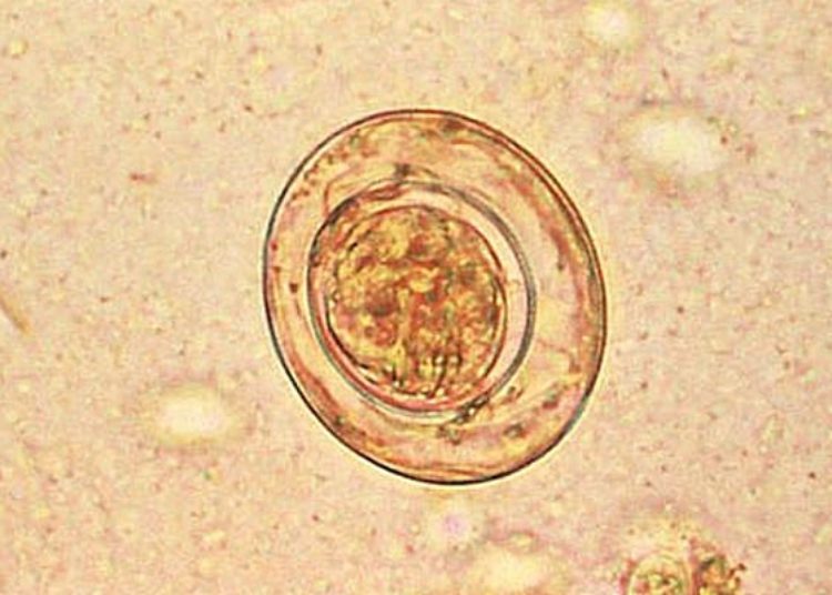 Neoplastic tapeworm cells may invade human tissue in immunocompromised hosts