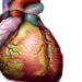 Radiation dose associated with increased heart disease in Hodgkin lymphoma survivors