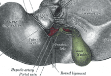 Maralixibat appears safe and efficacious for patients with Alagille syndrome and cholestatic pruritus