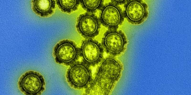 PD influenza H1N1 flu