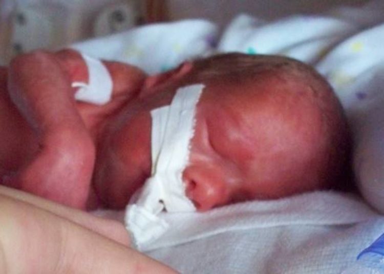AAP addresses neonatal pain prevention