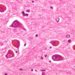 Genetic risk assessment for Alzheimer’s disease does not increase anxiety, depression or stress