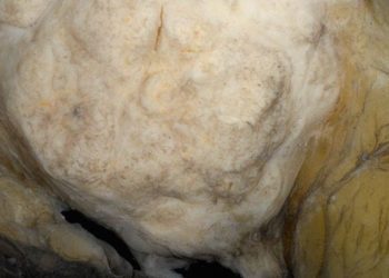 Age and breast cancer risk factors associated with false-positive mammography results