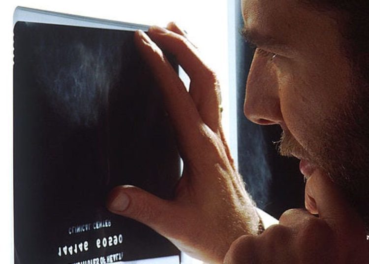 USPSTF recommends biennial screening mammography in 50 to 74 year-old women