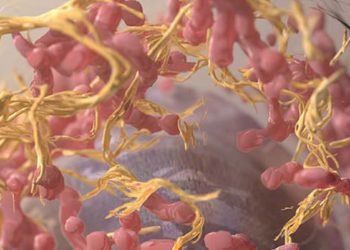 Women with pregnancy-associated melanoma at greater risk of metastasis, recurrence