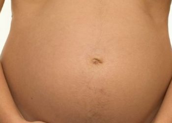 History of maternal anorexia linked to small infant size