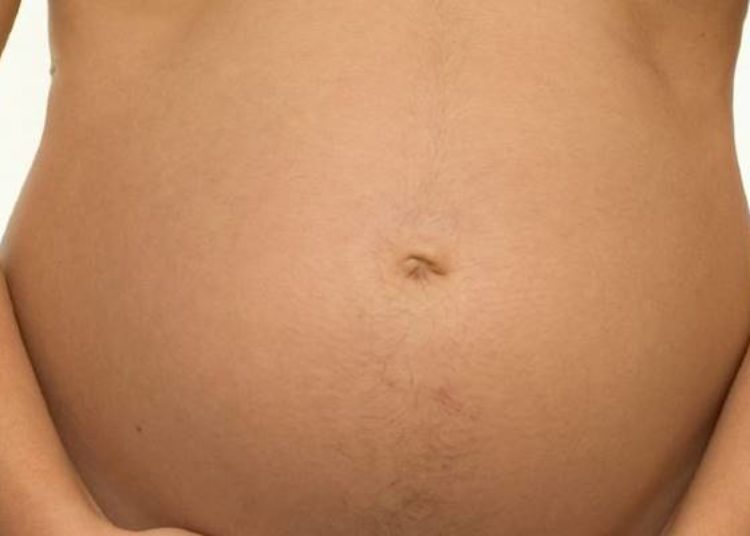 History of maternal anorexia linked to small infant size