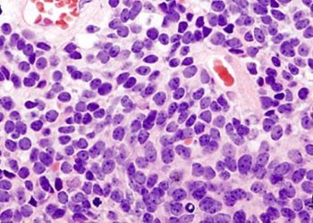 Proton radiotherapy for pediatric medulloblastoma demonstrates acceptable toxicity in phase 2 study