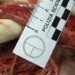 Remote patient monitoring did not reduce heart failure readmissions: The BEAT-HF trial