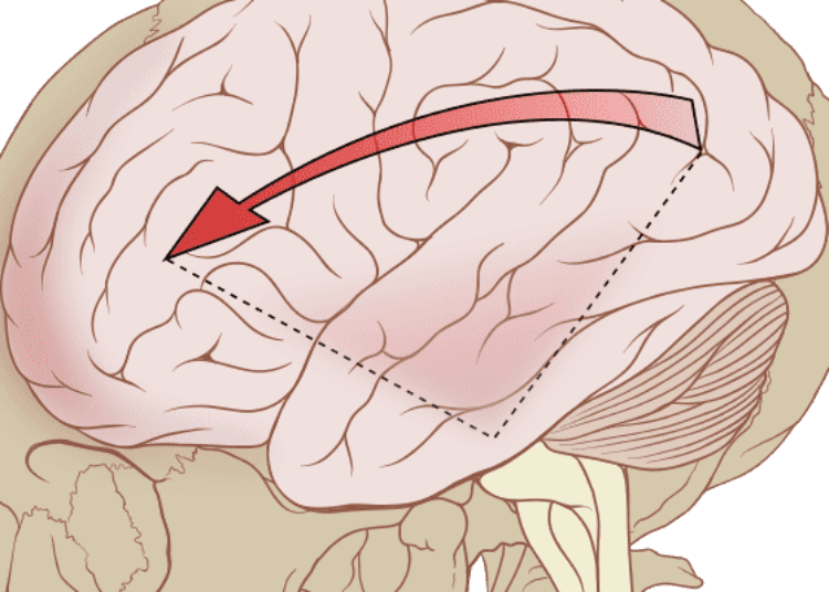 Predicting persistent postconcussion symptoms with a clinical risk score