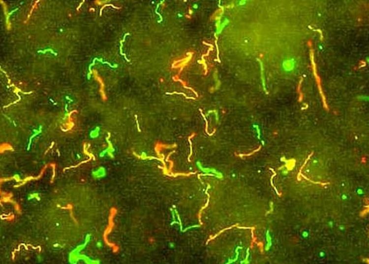 Longer duration of antibiotic therapy does not reduce persistent symptoms in Lyme disease