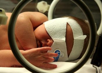 Confounding influences phototherapy’s association with increased childhood cancer risk