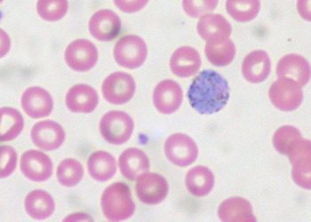 RTS,SA/S01 anti-malarial vaccine efficacy wanes significantly over time